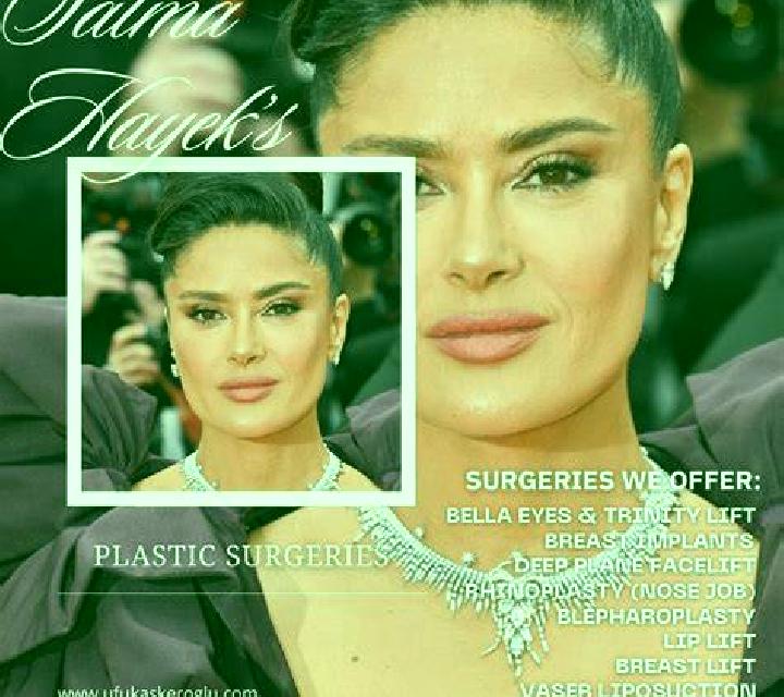 Estrella 2 Zarzosa escort