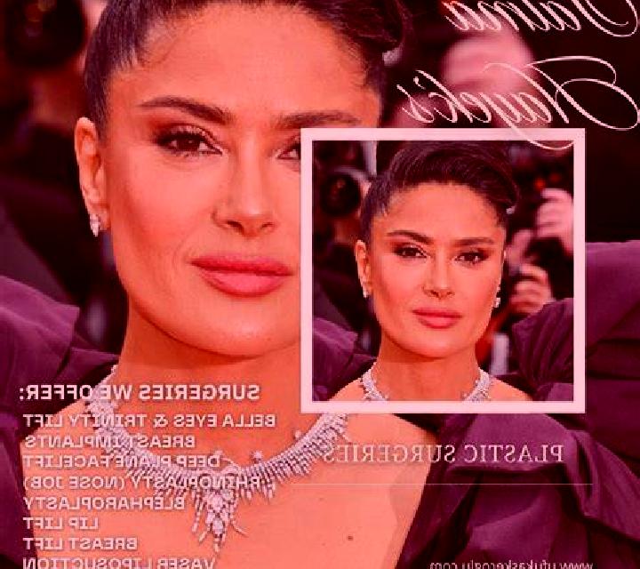 Rosa 2 Medrano escort