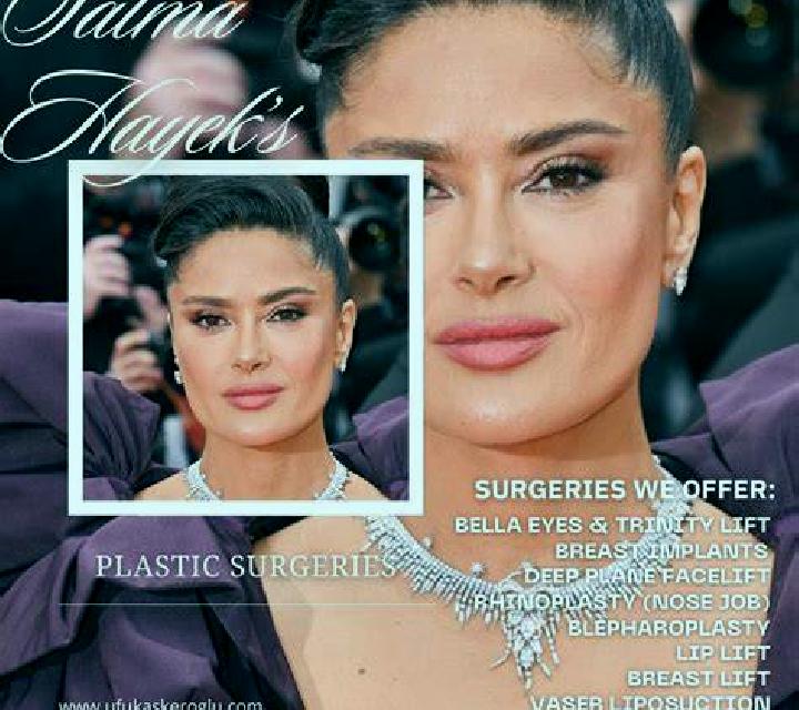 Salma la Teixonera escort